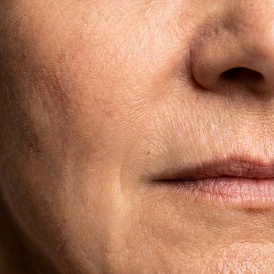 Starter Pack — Ringiovanimento Luminoso