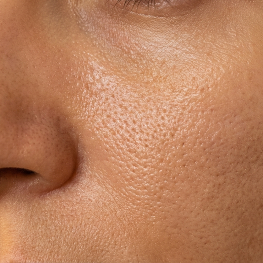 Starter Pack — Trattamento Pori Dilatati