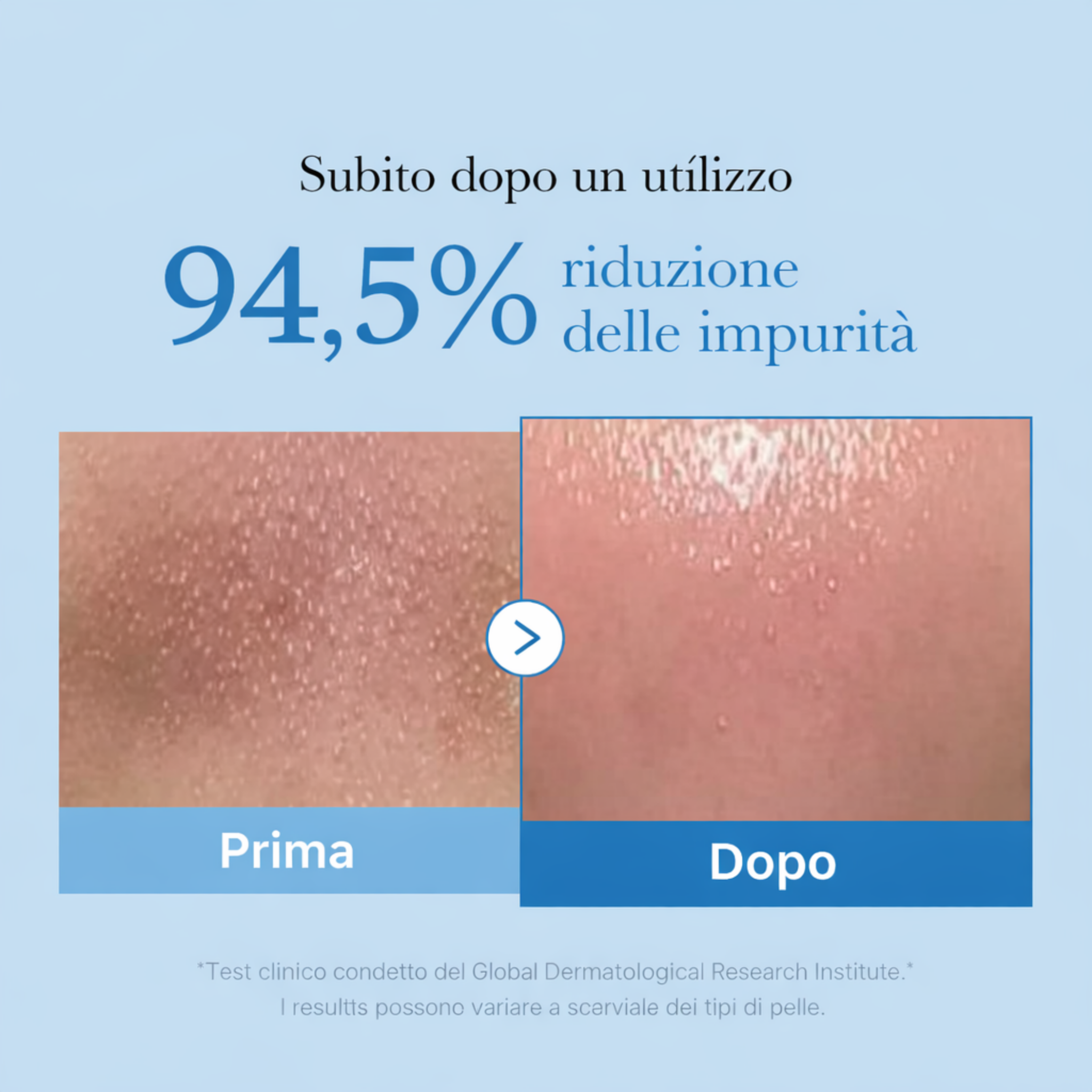 Pore Blackhead Deep - Olio Struccante- 205ml