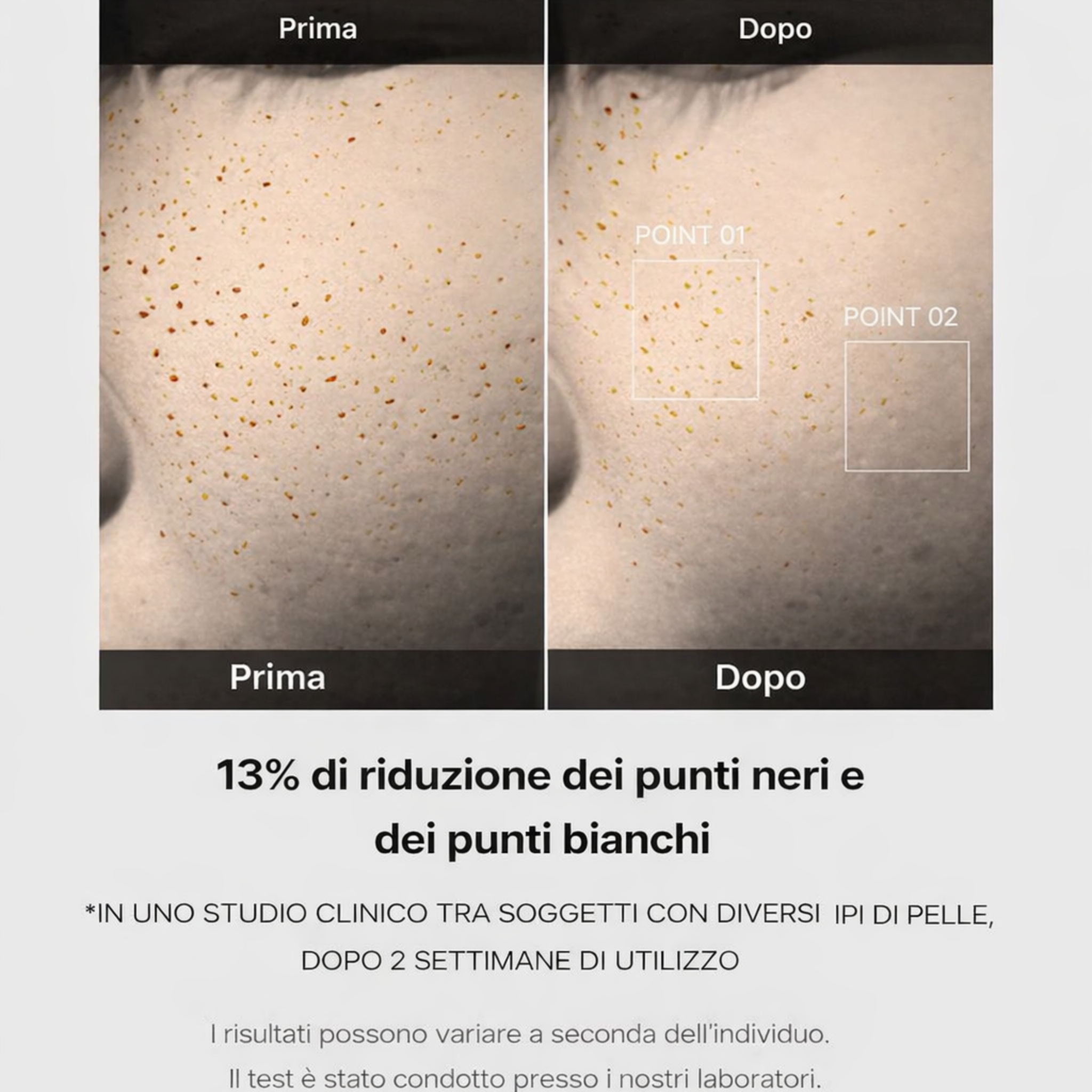 Zero Pore One Day Siero - Controllo Del Sebo - 30ml