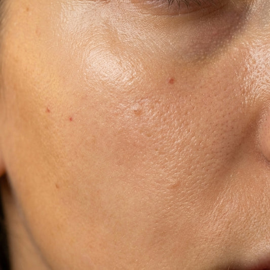 Starter Pack — Pelle Mista-Grassa-Impura